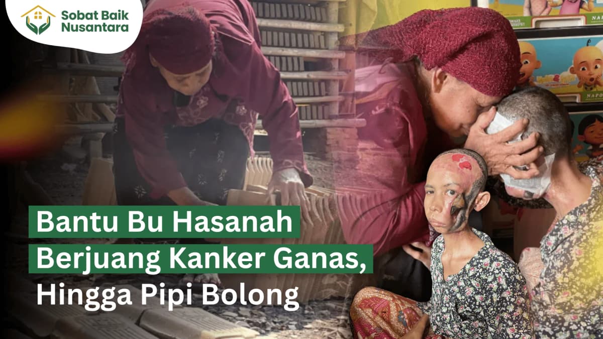 Foto campaign Melawan Kanker Kulit Ganas di Wajah: "Aku Harus Hidup demi Anakku"