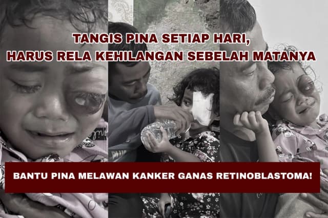 Bantu Pina Sembuh dari Kanker Mata