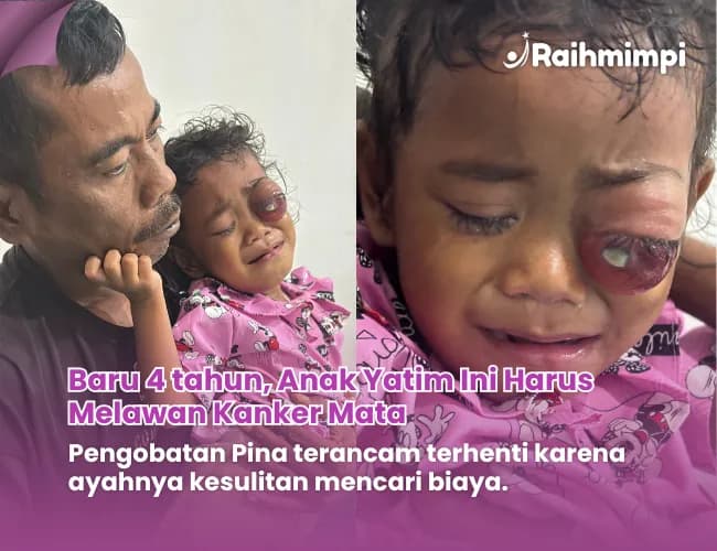 Foto campaign Bantu Pina Sembuh dari Kanker Mata