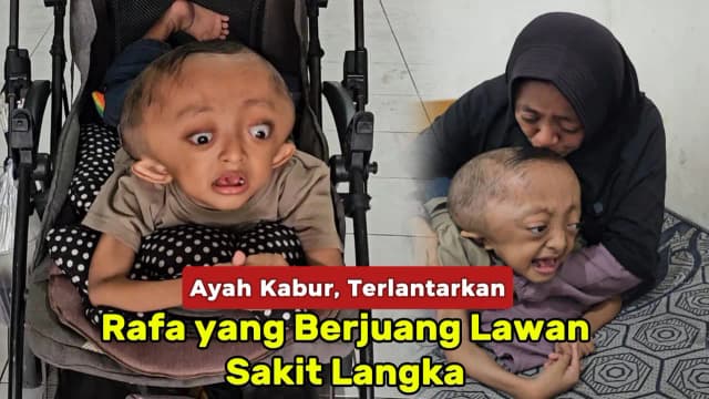 Bantu Rafa Sembuh dari Sakit Langka