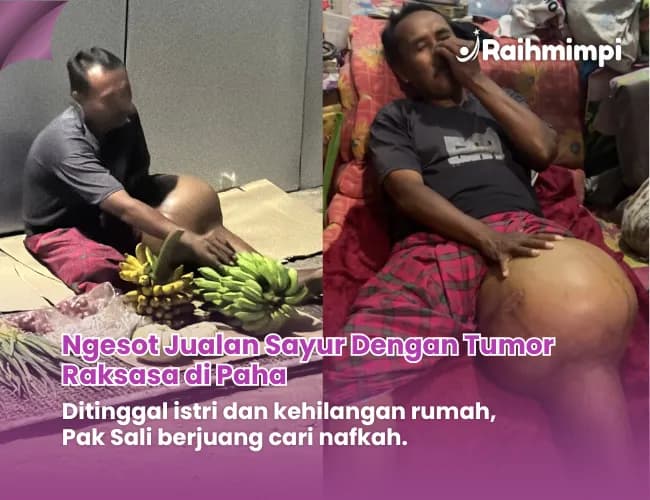 Foto campaign Tolong Ngesot Bertahan Hidup karena Tumor Raksasa