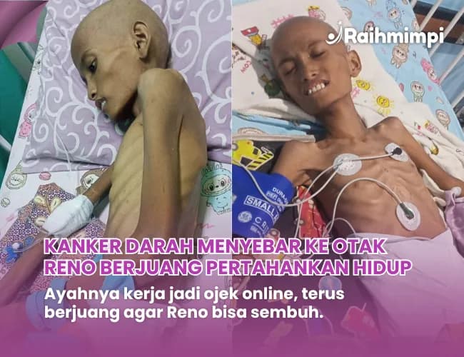 Foto campaign URGENT.. Kanker darah menyebar ke otak serang anak Ojol