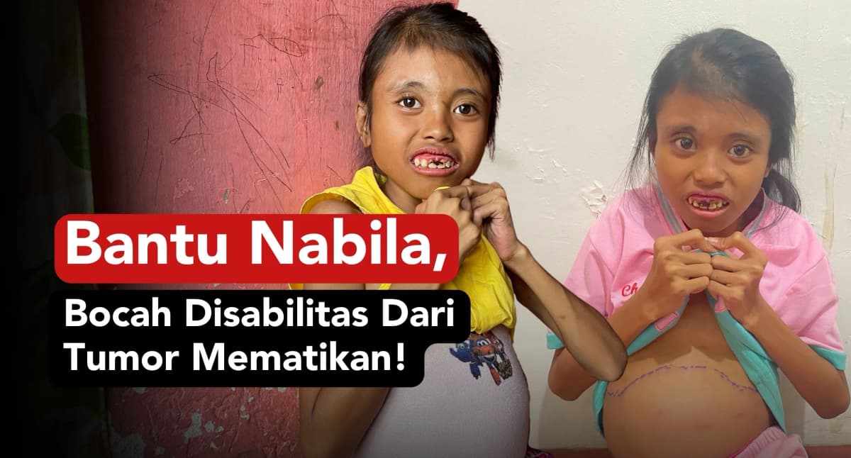Foto campaign Bantu Nabila Disabilitas Sembuh dari Tumor Mematikan