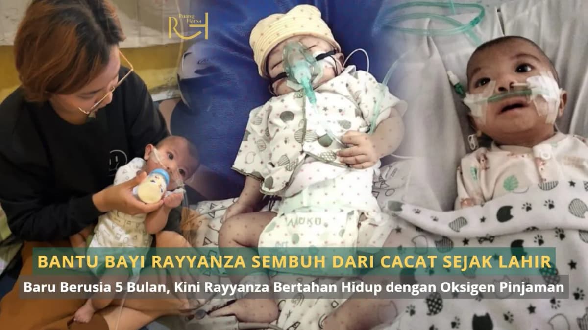 Foto campaign Bantu Bayi Rayyanza Sembuh dari Kelainan Sejak Lahir