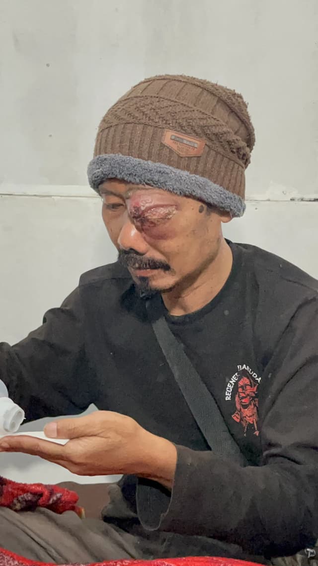 Sebatang Kara Melawan Tumor - Bantu Selamatkan Penglihatan Pak Eden 