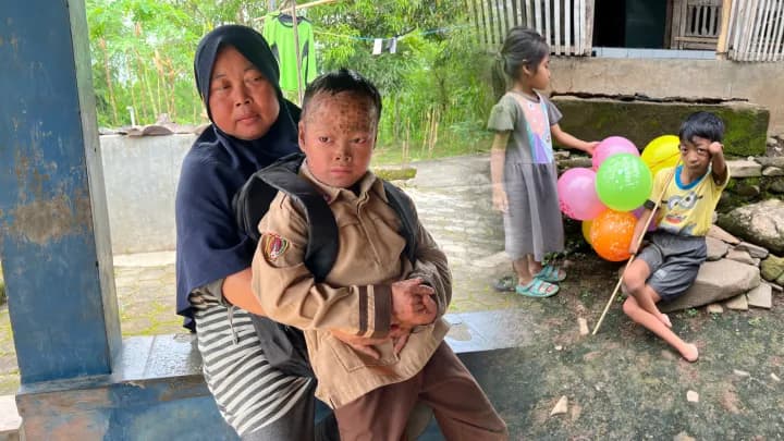 Foto campaign Bantu Orang Tua Hidupi Anak Kelainan