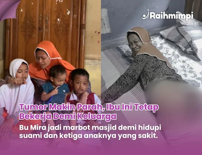 Foto campaign Tumor Makin Besar Mari Bantu Perjuangan Ibu Mira Tuk Sembuh