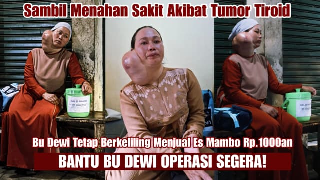 Tolong Tukang Es Mambo Dari Ganasnya Kanker Tiroid