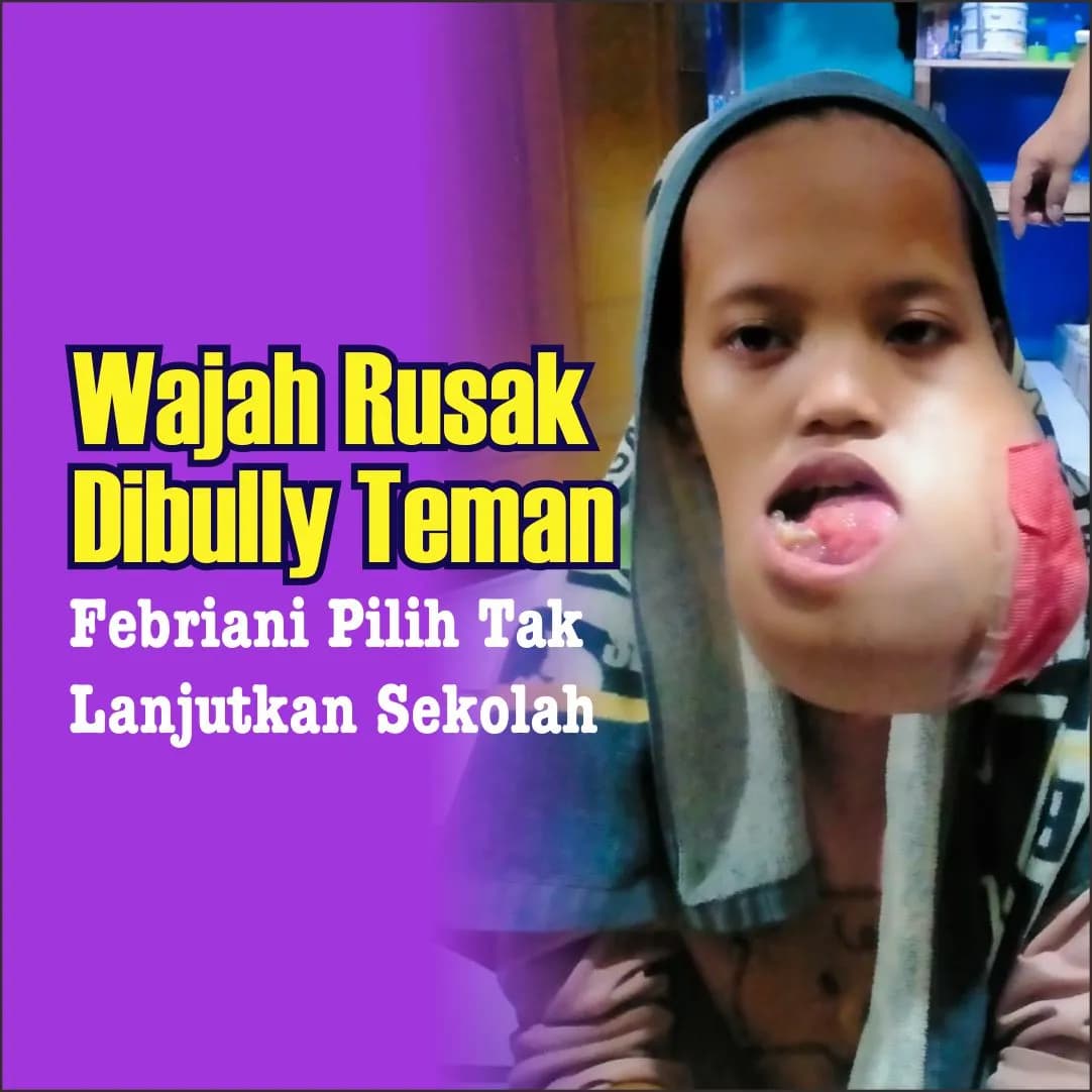 Foto campaign Sakit Tumor dan Nyaris Depresi Karena Dibully