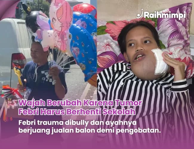 Foto campaign Sakit Tumor dan Nyaris Depresi Karena Dibully