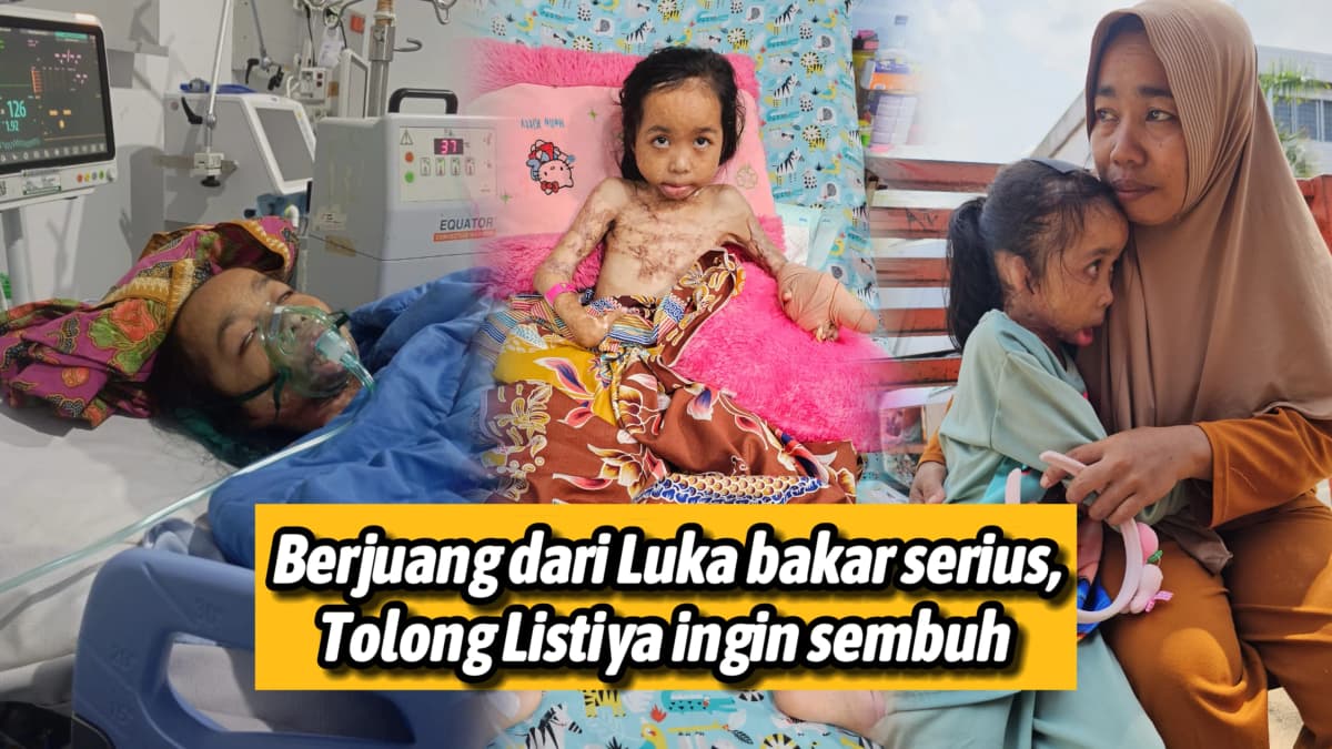 Foto campaign Tolong Listiya Sembuh dari Luka bakar serius