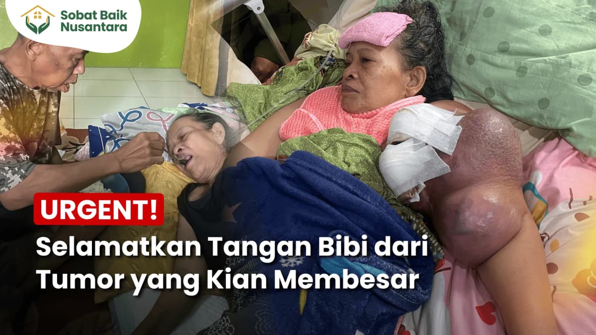 Foto campaign Tangan Hampir Diamputas Bantu Perjuangan Bu Bibi Melawan Tumor Ganas