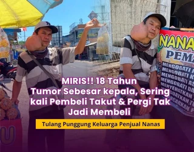 Foto campaign 18 Tahun Berjuang Seorang Ayah dengan Tumor Sebesar Kepala