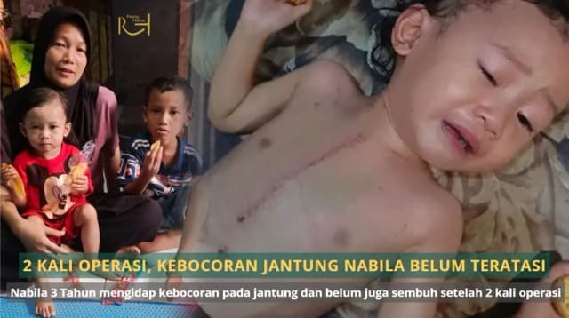 Sudah 2 Kali Operasi Jantung Nabila Masih Berjuang untuk Sembuh