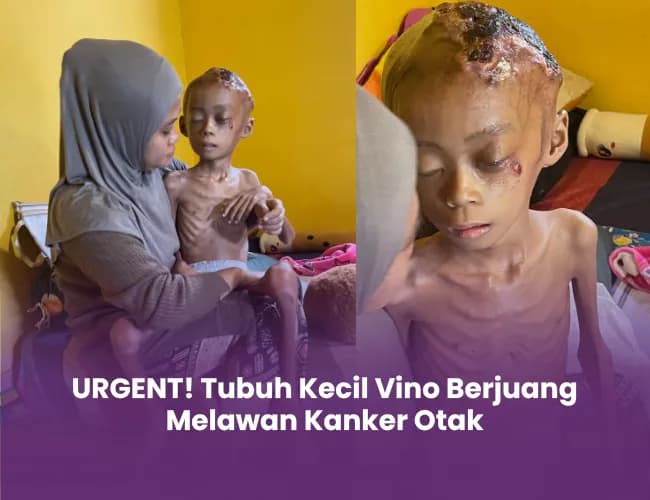 Foto campaign URGENT! Tubuh Kecil Vino Berjuang Melawan Kanker Otak