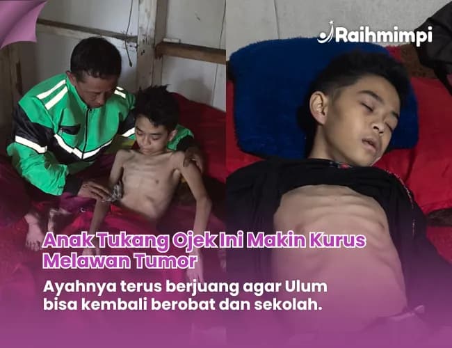 Foto campaign Ulum Terbaring Lemah Melawan Tumor Bantu Wujudkan Hararapan
