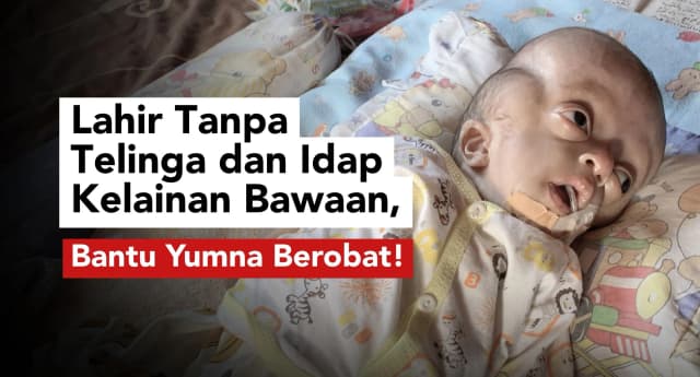Lahir tanpa telinga Idap Kelainan Ganda Bantu bayi Yumna Berobat