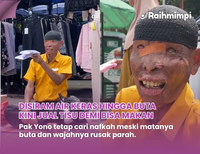 Foto campaign Disiram Air Keras Hingga Buta Pak Yono Kini Jual Tisu
