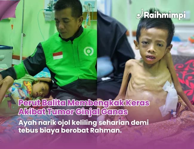 Foto campaign Perut Rahman Membesar Digerogoti Tumor