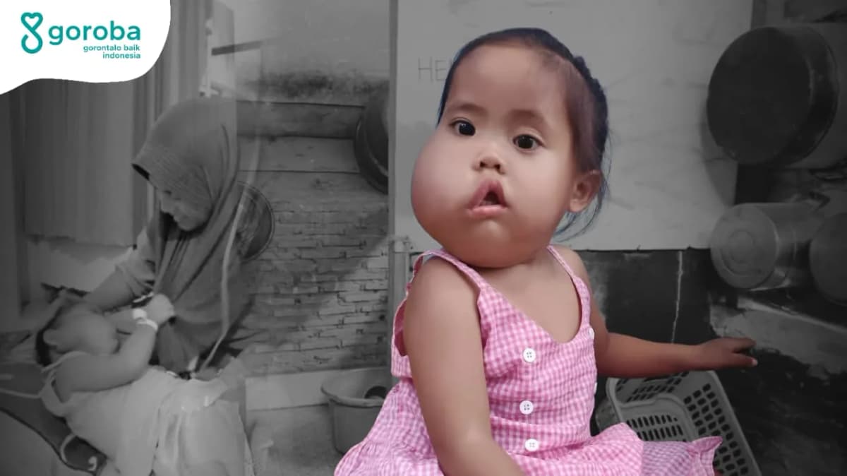 Foto campaign Tumor Membesar Azalia Nanti Mukjizat Operasi