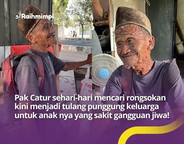 Tukang Rongsok Idap Penyakit Kulit Langka Rawat 2 Anak ODGJ