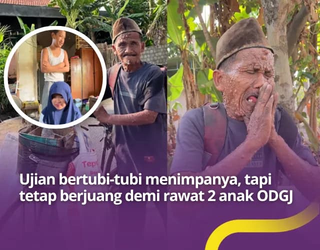 Foto campaign Tukang Rongsok Idap Penyakit Kulit Langka Rawat 2 Anak ODGJ