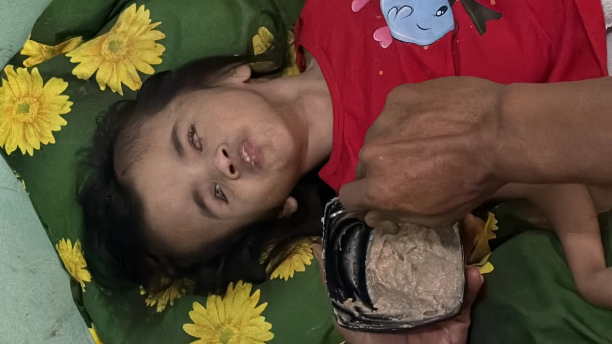 Foto campaign Bantu Anak Pejuang Hidrosefalus Berobat dan Tetap Memiliki Tempat Tinggal