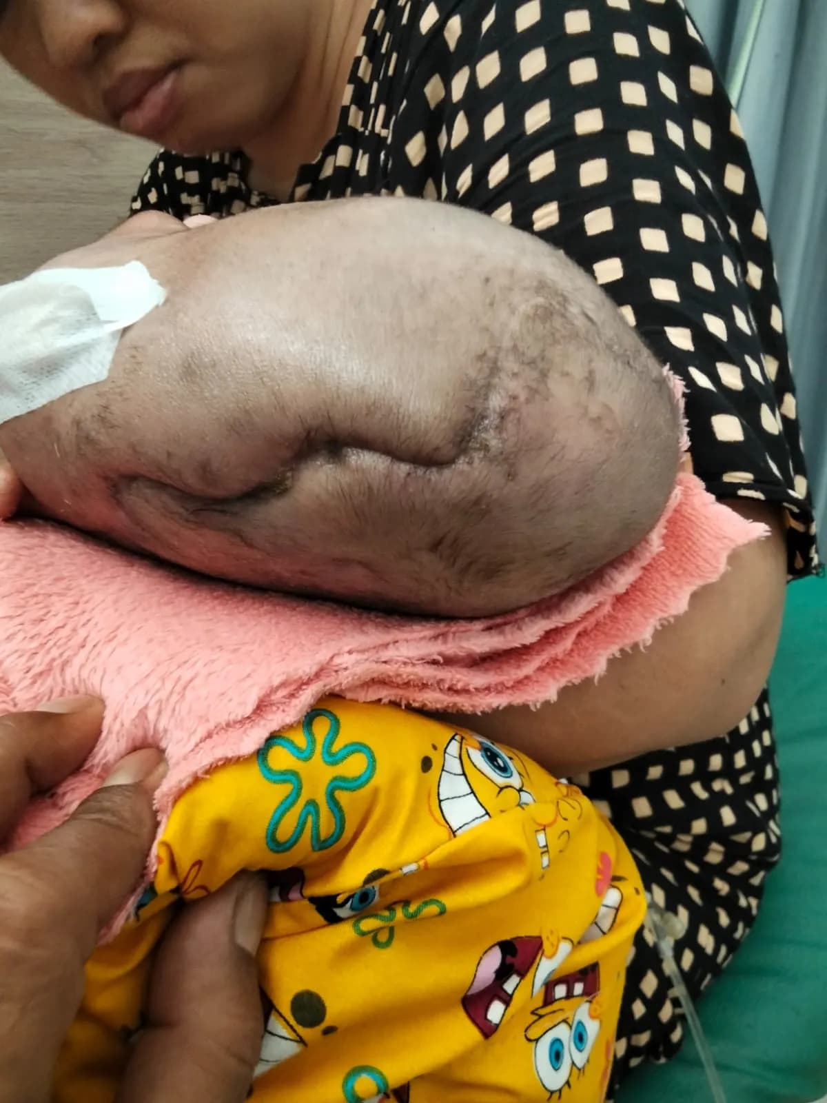 Foto campaign Selamatkan Azril 1 tahun Dari Kelainan Langka