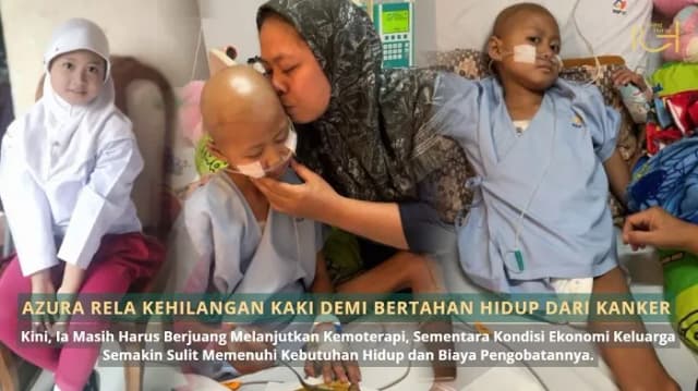 Azura Rela Kehilangan Kaki Demi Bertahan Hidup dari Kanker