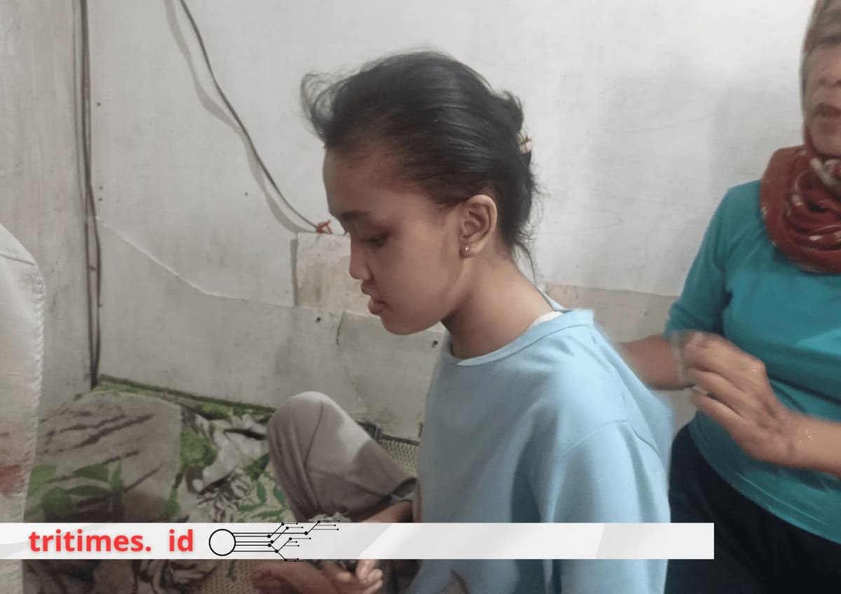 Foto campaign Devi,Disabilitas Mental yang Terkurung di Kontrakan Sempit