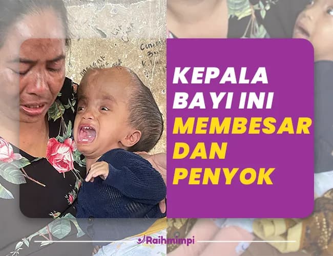 Selamatkan Nyawa Adik Ayla dari Penyakit Langka