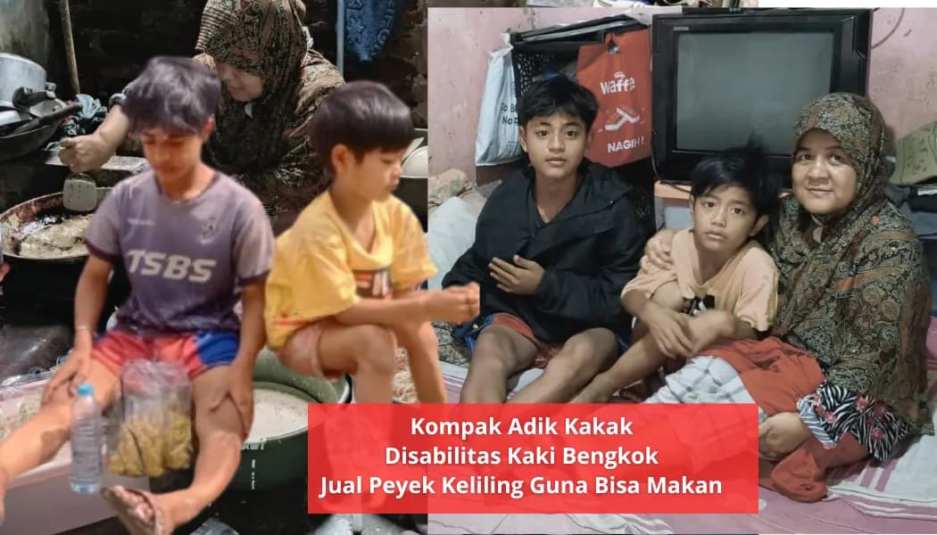 Foto campaign Tangis Keluarga Kaki Bengkok di Rumah Bocor Butuh Uluran Anda
