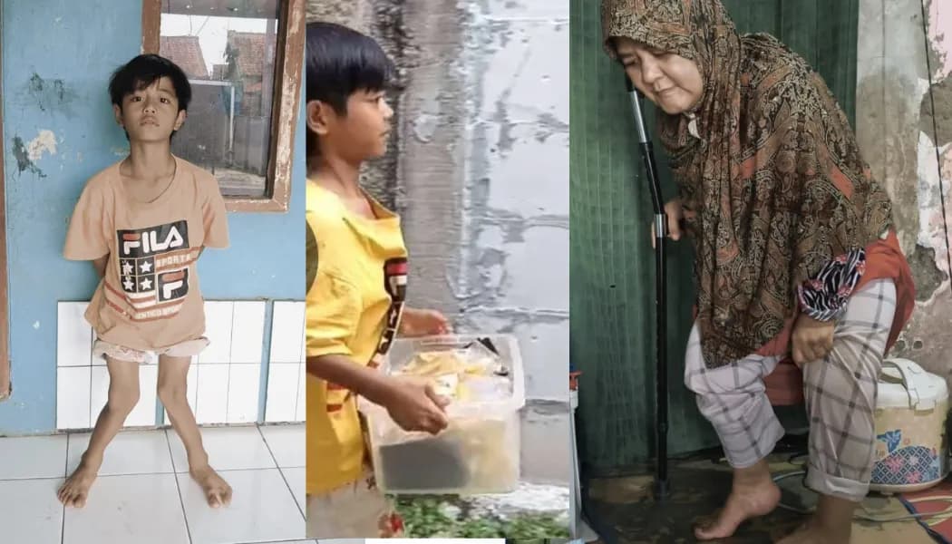 Foto campaign Tangis Keluarga Kaki Bengkok di Rumah Bocor Butuh Uluran Anda