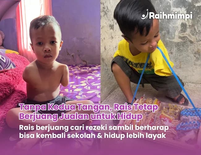 Foto campaign Kisah Pilu Anak Yatim Disabilitas Rais Tidak memiliki kedua Tangan