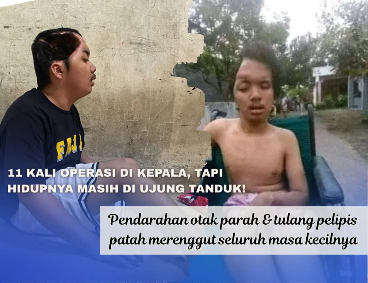 Foto campaign Perjuangan Panjang Fajah, Korban Tabrak Lari Sejak Usia 3 Tahun
