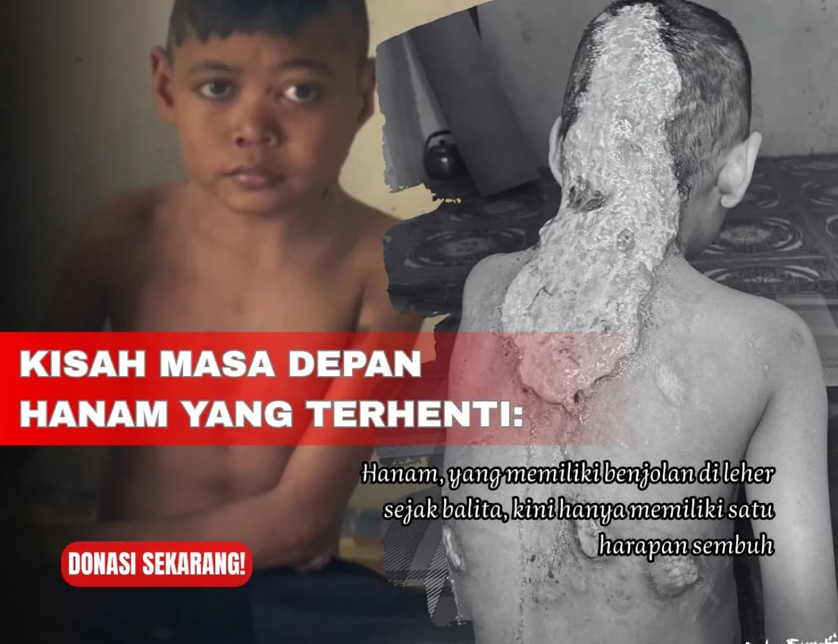 Dukung Hanam Sembuh dan Kembali Bersekolah Lagi