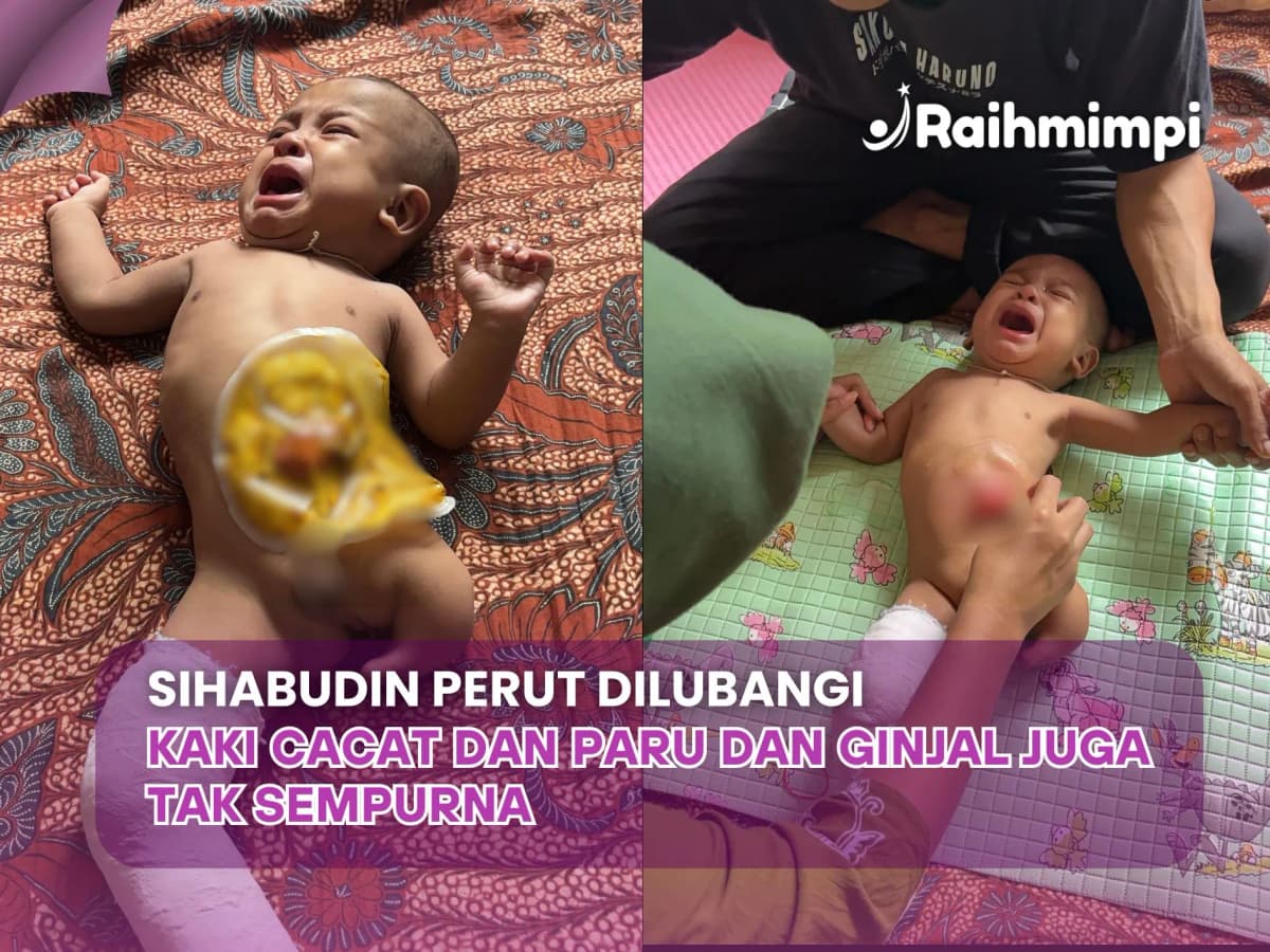 Foto campaign Tanpa Anus, Tanpa Kaki. Bantu Sihabudin Berjuang Sembuh