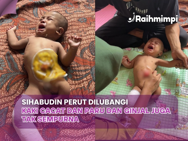 Tanpa Anus, Tanpa Kaki. Bantu Sihabudin Berjuang Sembuh