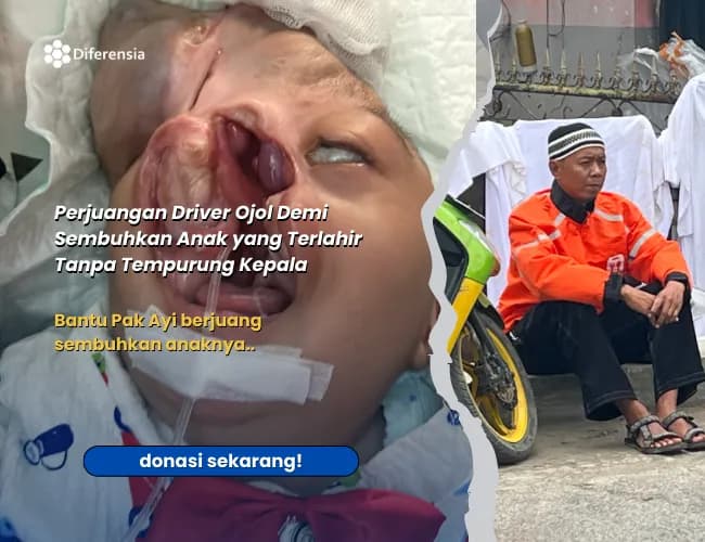 Foto campaign Patungan Untuk Kesembuhan Yasin, Bayi Tanpa Tempurung