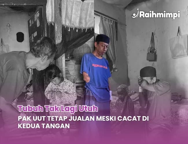 Tangan Buntung, Pak Uut Disabilitas Berjuang Cari Nafkah