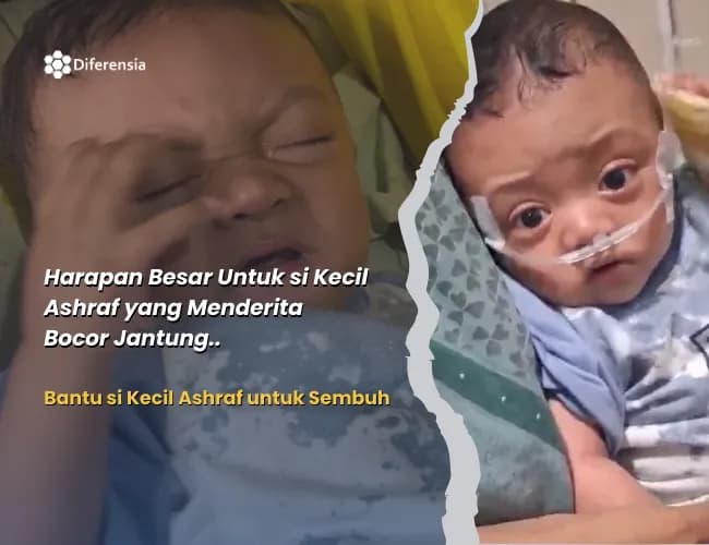 Foto campaign Ditelantarkan Orang Tua. Patungan untuk Kesembuhan Bayi Ashraf