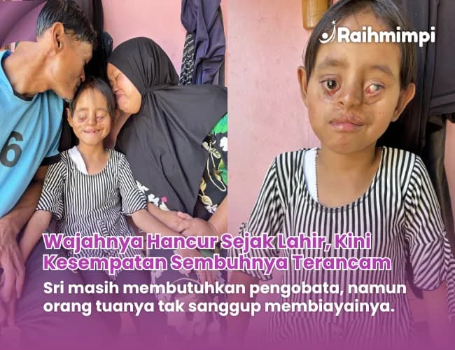 Foto campaign Urgent Kisah pilu Sri Derita Penyakit Langka