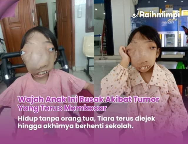 Bantu Ukir Senyuman Para Pejuang Sembuh