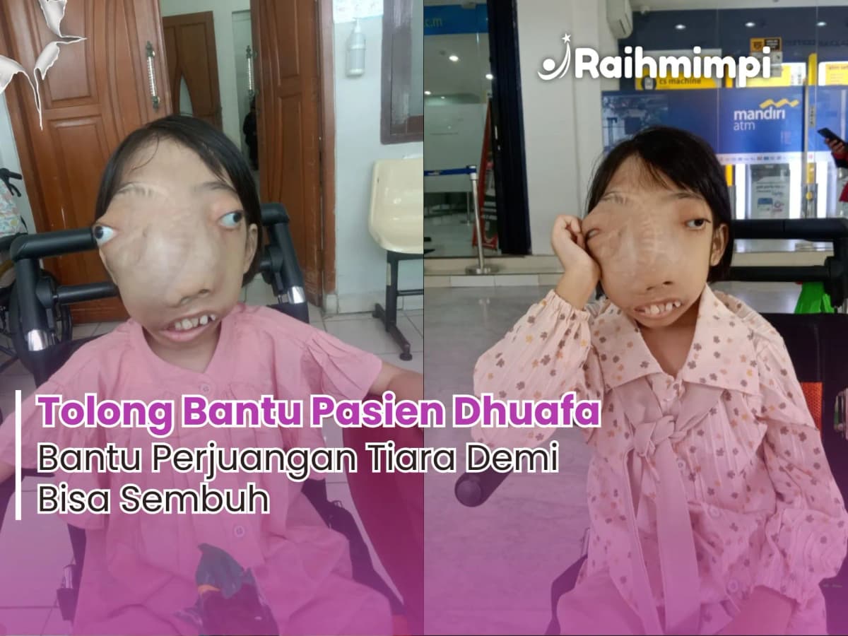 Foto campaign Bantu Ukir Senyuman Para Pejuang Sembuh