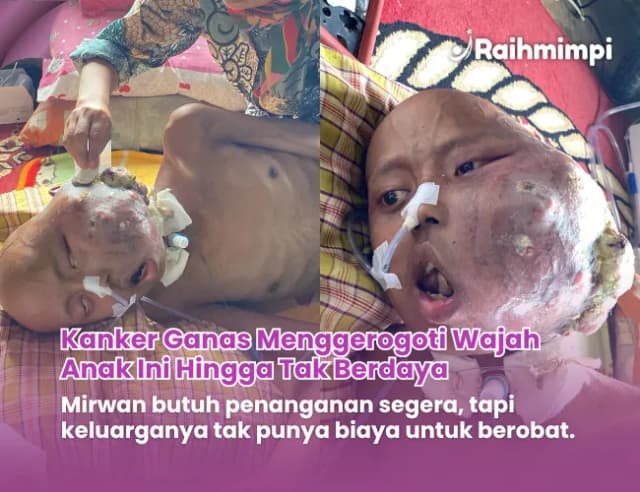 Jaga Harapan Selamatkan Para Pejuang Kesembuhan