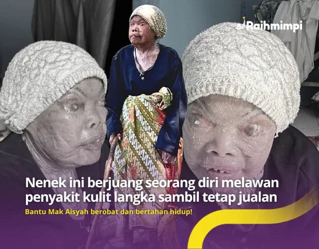 Foto campaign URGENT Bantu Nenek Sebatangkara Idap Sakit Kulit Langka