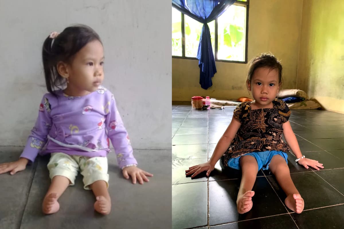 Foto campaign Miliki Kelainan Kaki Sejak Lahir. Bantu Mala Sembuh