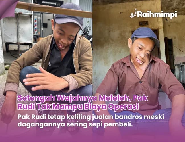 Foto campaign SETENGAH MUKA MELELEH Pak Rudi Tetap Berjualan Bandros untuk Keluarga