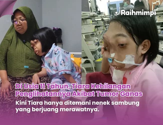 Foto campaign 11 Tahun Tiara Melawan Tumor Ganas - Ia Hanya Ingin Sekolah Lagi