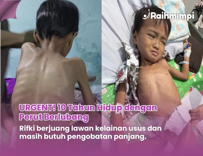 Foto campaign Idap Hirschsprung dari Lahir Rifki Kini Hanya Bisa Terbaring Lemah